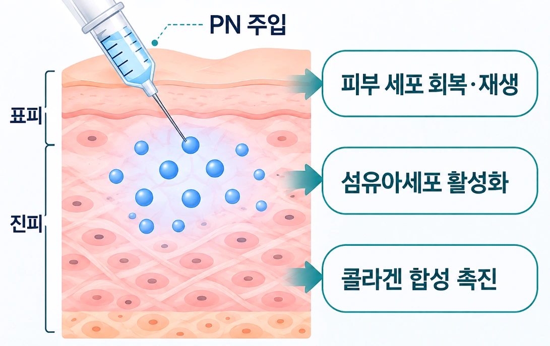 리쥬란 PN 성분을 진피층에 주입한 후 피부 세포 회복과 콜라겐 합성을 촉진하는 원리를 나타낸 피부 단면도