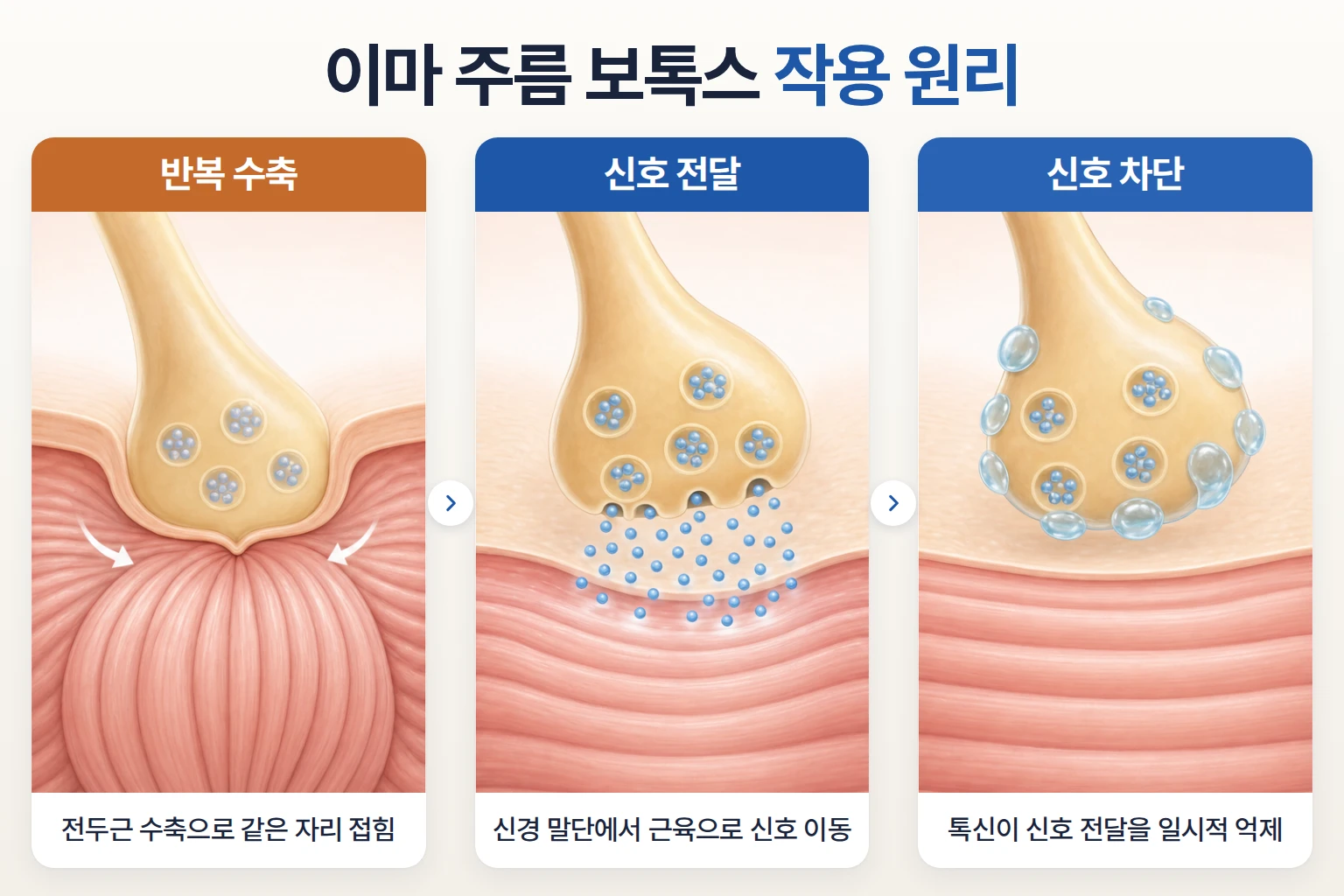 전두근 수축 신호 전달과 보툴리눔 톡신의 신경 신호 억제 과정