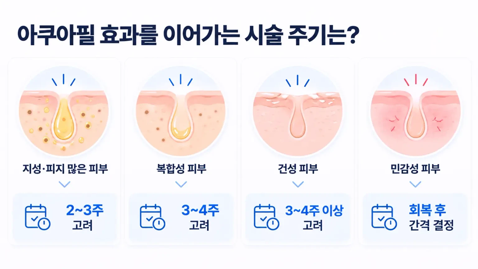 아쿠아필 시술 주기를 피부 타입별로 비교한 피부과 교육용 인포그래픽