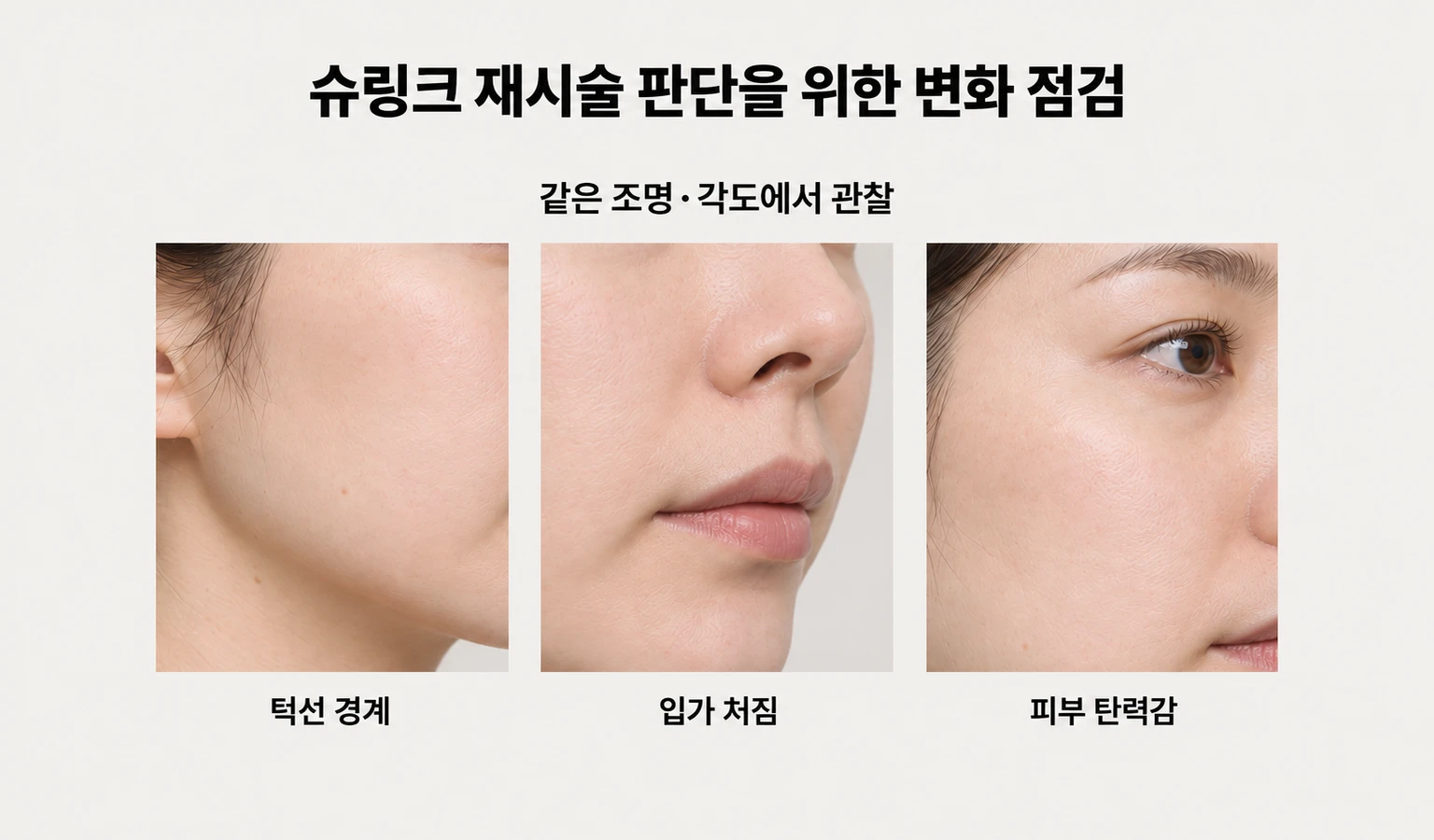 같은 조명과 각도에서 살펴보는 턱선 경계·입가 처짐·피부 탄력