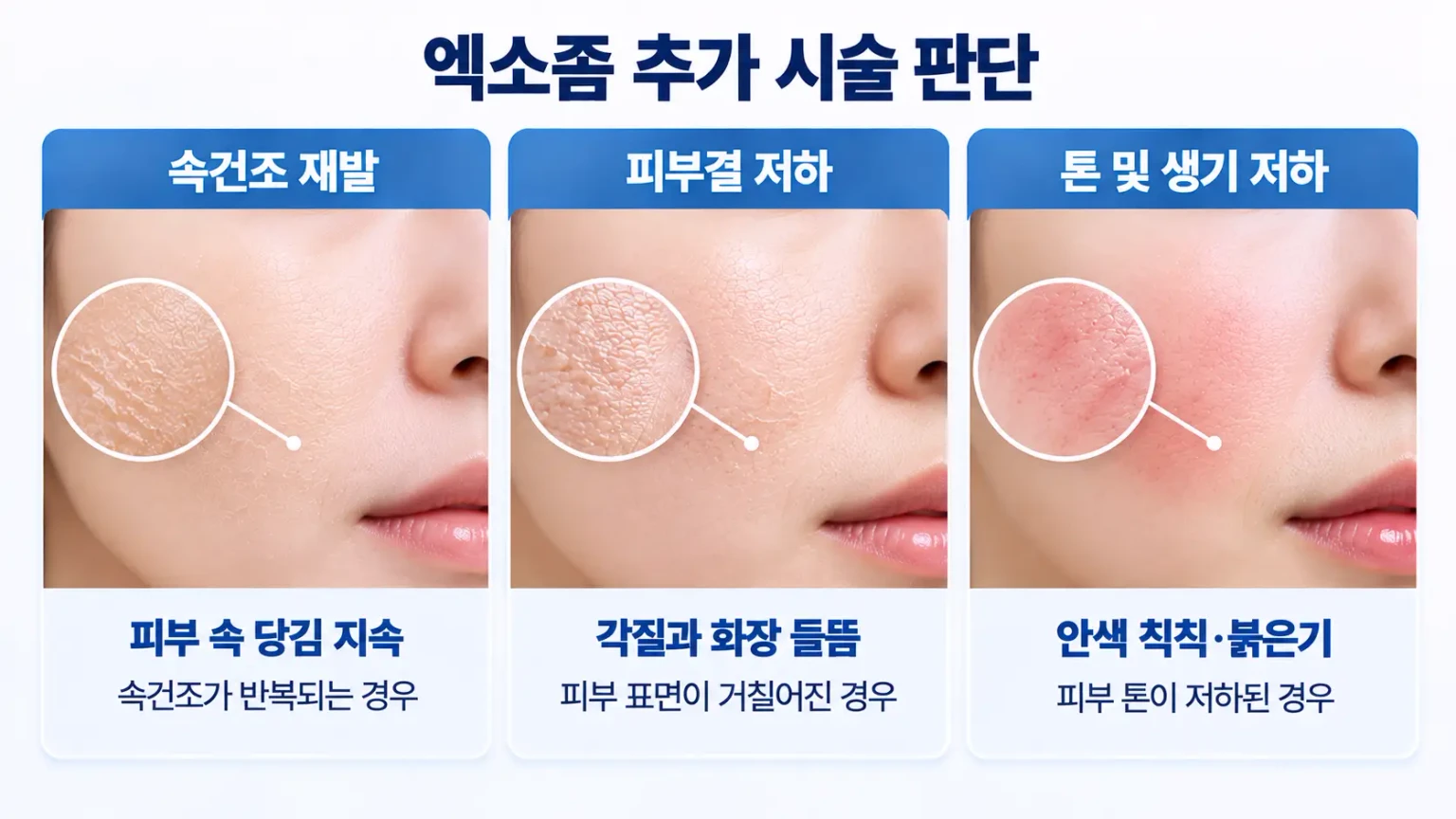 엑소좀 추가 시술 판단을 위한 속건조 재발, 피부결 저하, 톤 및 생기 저하 비교 인포그래픽