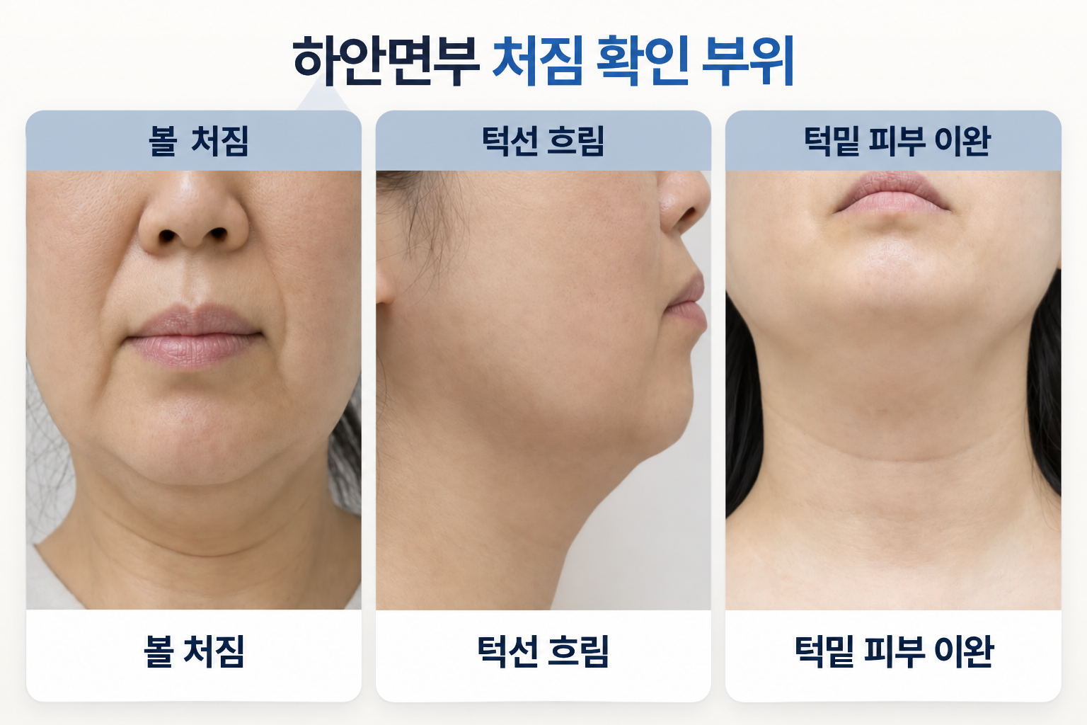 볼 처짐 턱선 흐림 턱밑 피부 이완 부위 비교