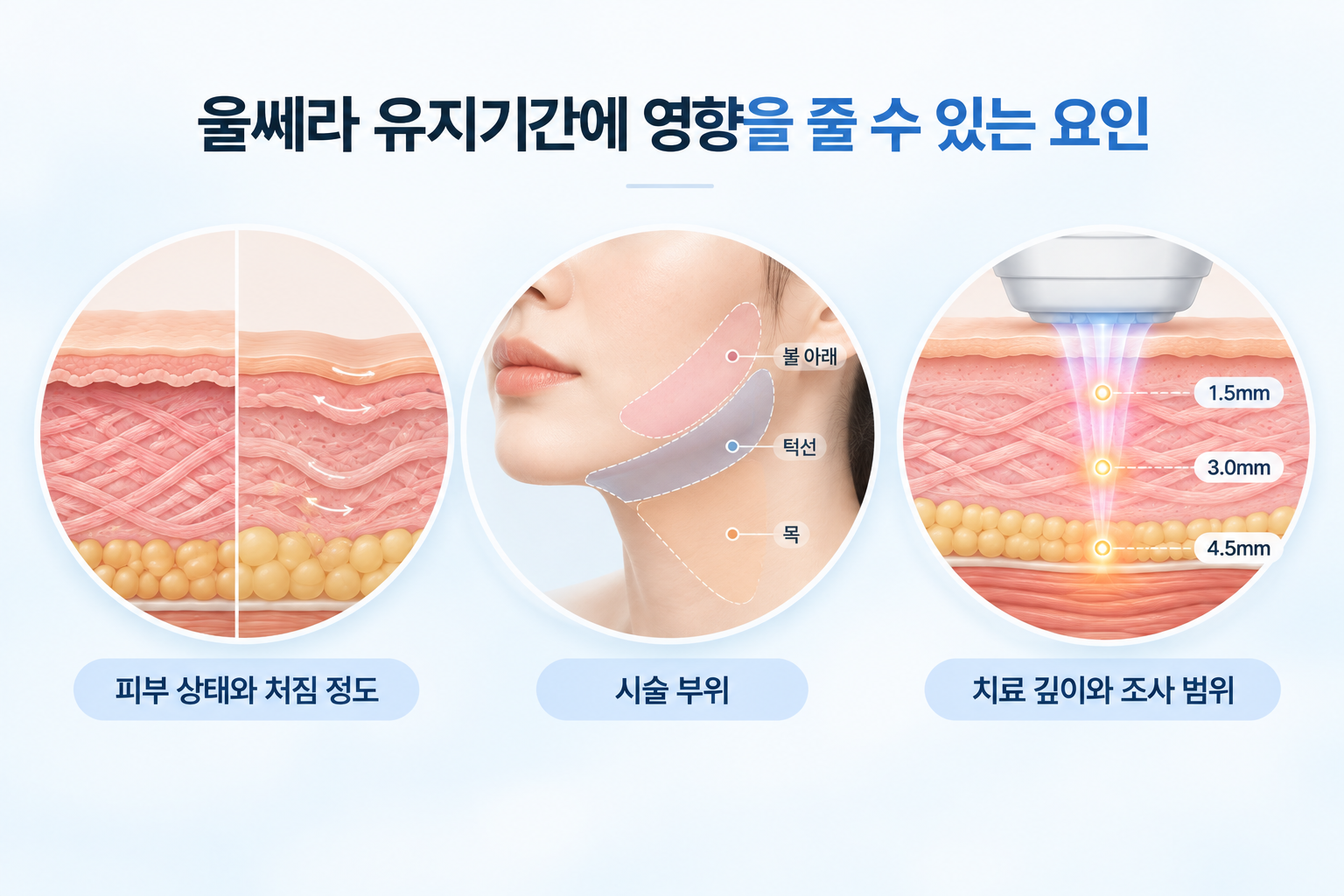 울쎄라 유지기간에 영향을 줄 수 있는 피부 상태와 처짐 정도, 시술 부위, 치료 깊이와 조사 범위