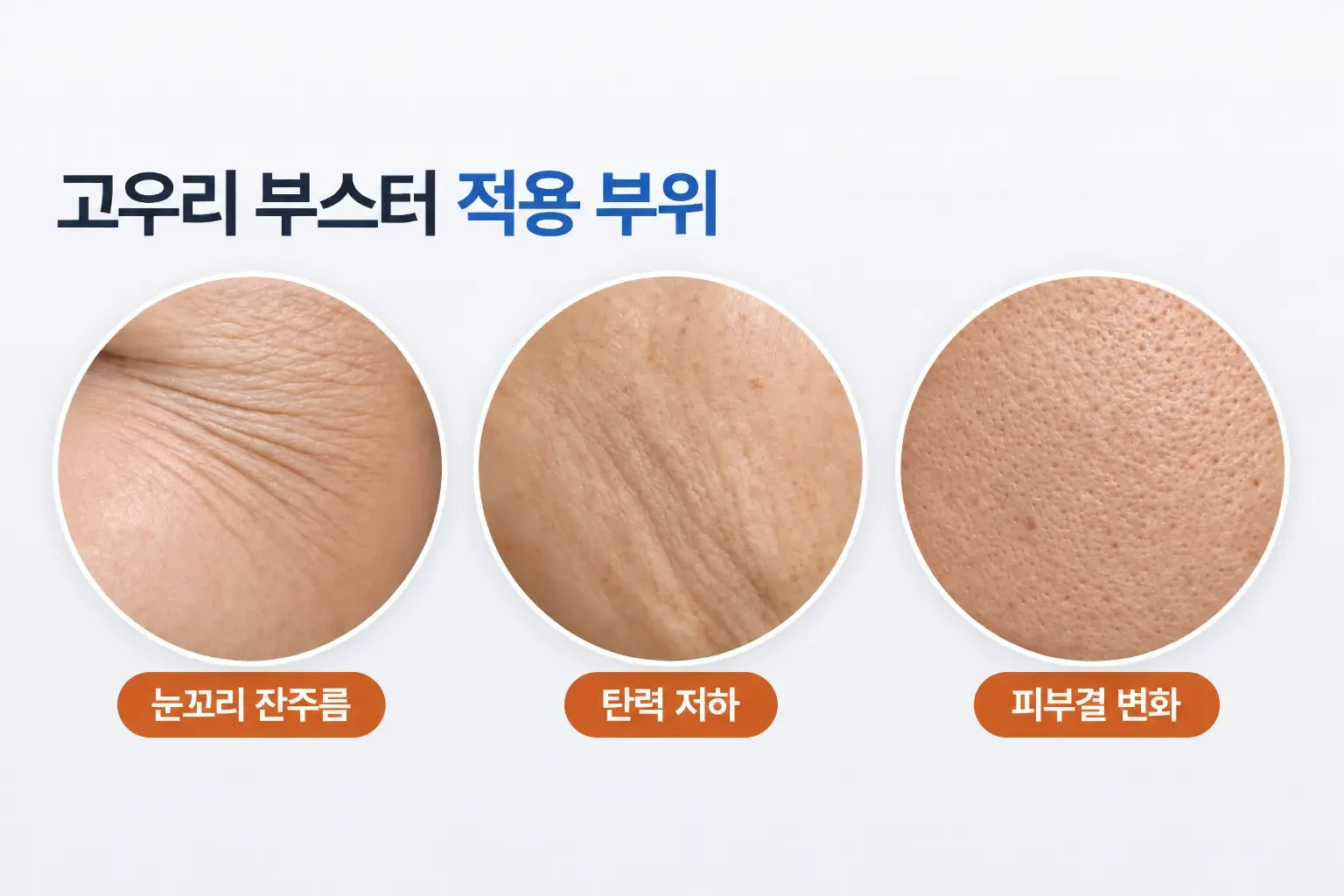 눈꼬리 잔주름, 탄력이 떨어진 피부, 거칠어진 피부결을 같은 배율로 나란히 비교한 피부 확대 사진