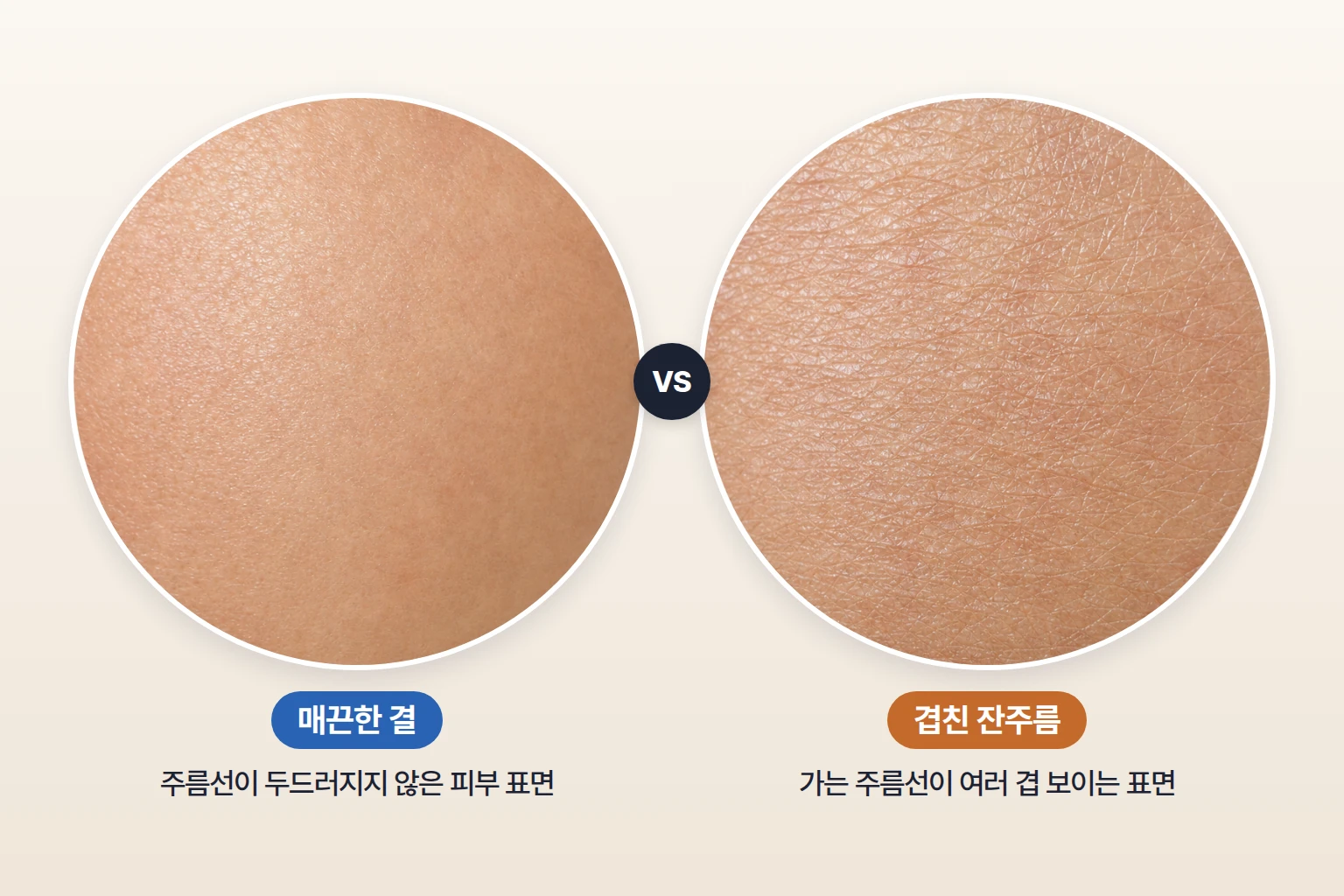 매끈한 피부 표면과 가는 주름선이 겹친 표면을 동일 배율로 비교한 설명용 피부 확대 사진