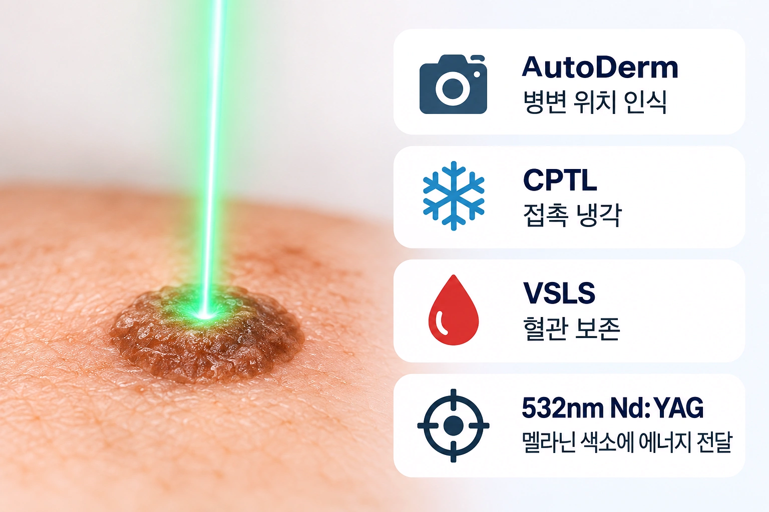 리팟레이저의 AutoDerm·CPTL·VSLS 기능과 532nm 레이저의 색소 치료 원리를 설명한 인포그래픽