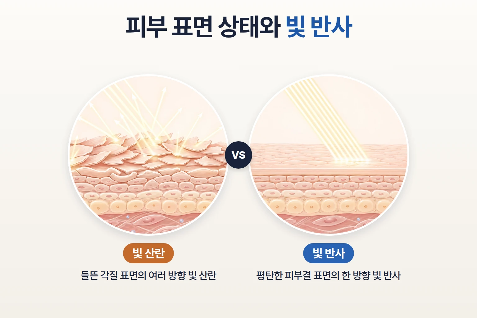 각질이 들뜬 거친 피부 표면의 빛 산란과 평탄한 표면의 빛 반사를 나란히 비교한 일러스트