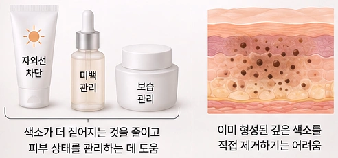 자외선 차단과 미백·보습 관리로 색소가 짙어지는 것을 줄일 수 있지만 이미 형성된 깊은 색소는 별도 치료가 필요할 수 있음을 나타낸 이미지