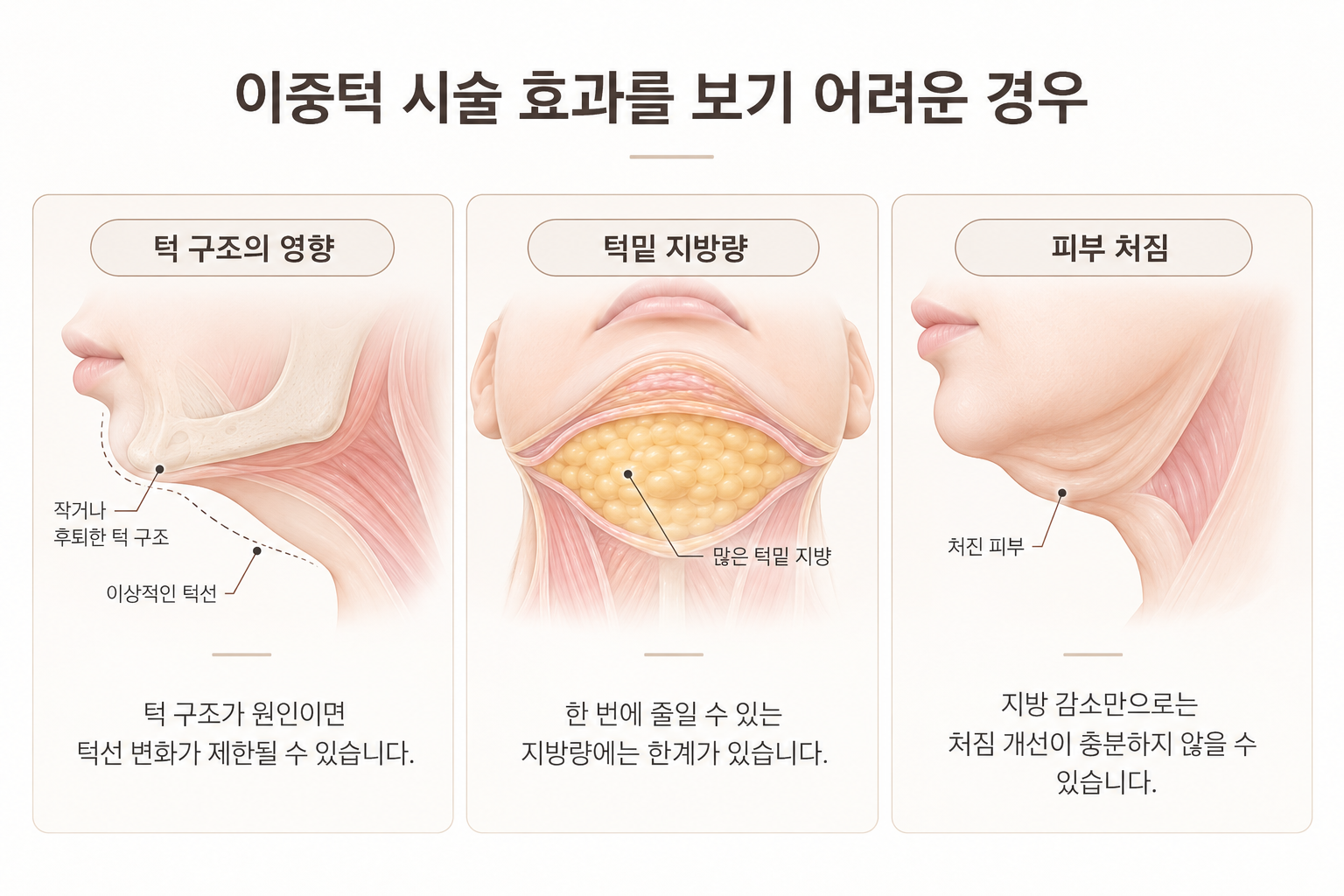 이중턱 시술 효과가 제한될 수 있는 턱 구조 턱밑 지방량 피부 처짐 비교