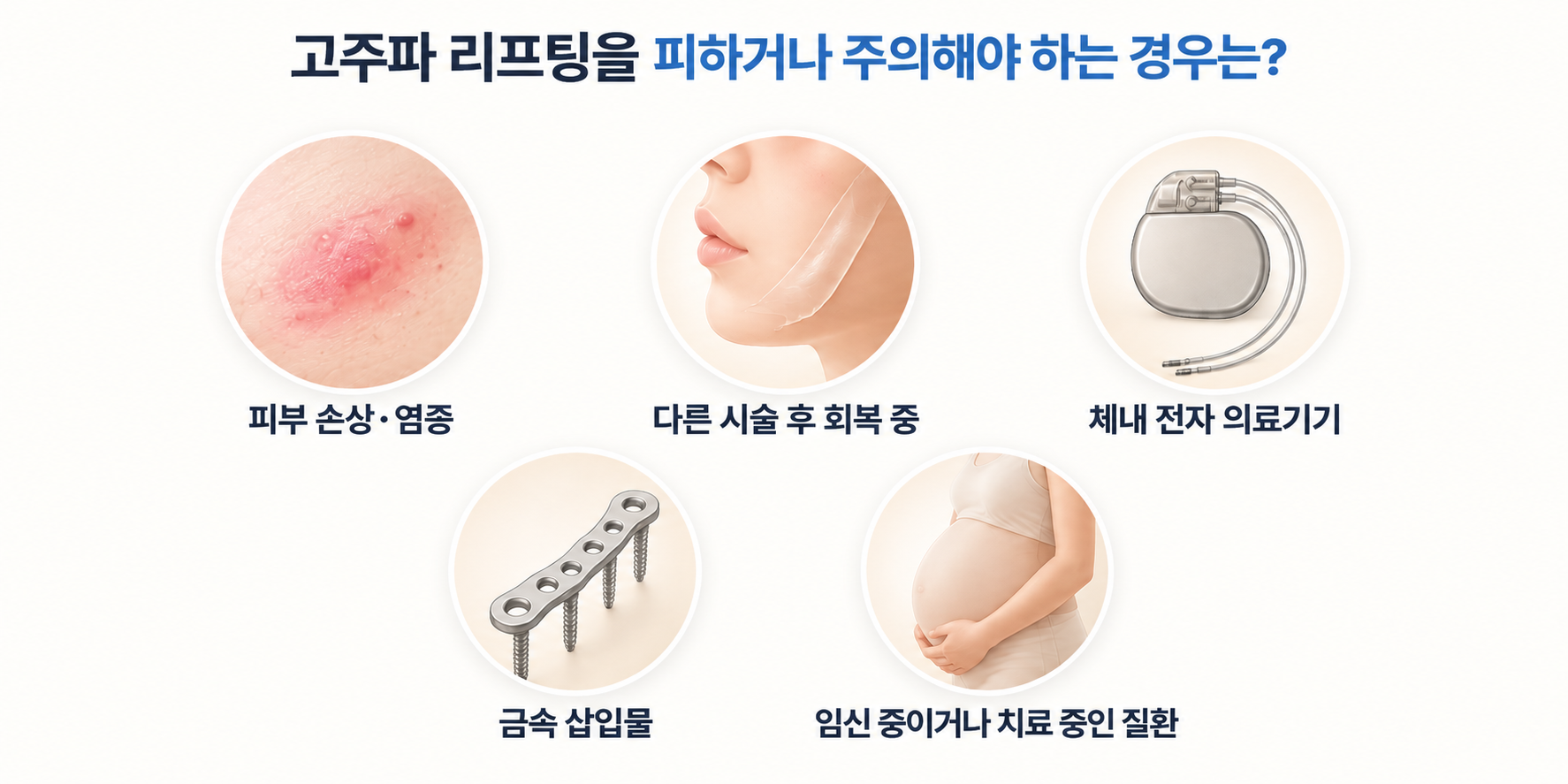 고주파 리프팅 전 확인하는 피부 손상 체내 전자 의료기기 금속 삽입물 임신 조건