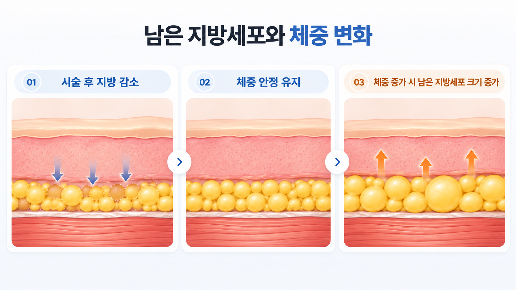 이중턱 주사 후 체중 유지와 증가에 따른 남은 지방세포 크기 변화