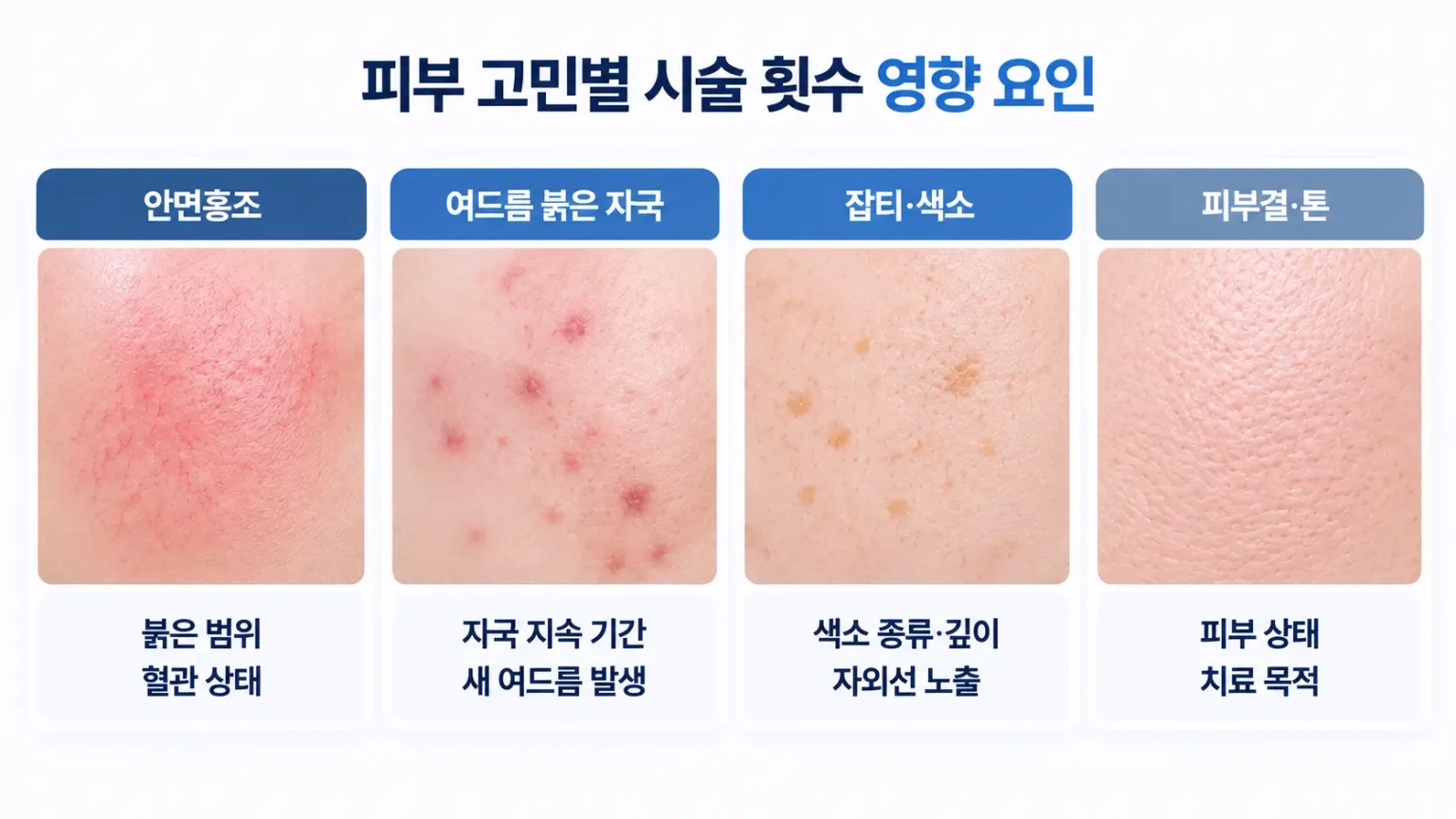 안면홍조, 여드름 붉은 자국, 갈색 잡티가 나타난 볼 피부 표면을 동일 배율로 비교한 확대 사진