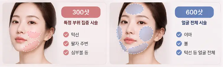 덴서티 300샷과 600샷의 시술 범위 및 적용 부위 차이