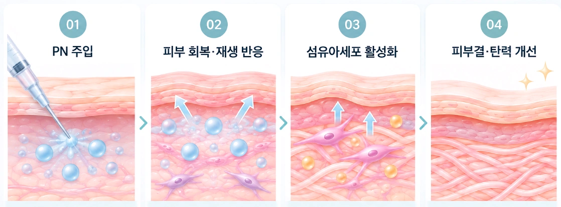 리쥬란 PN 주입 후 피부 회복 반응부터 피부결과 탄력 개선까지 4단계 원리를 나타낸 피부 단면도