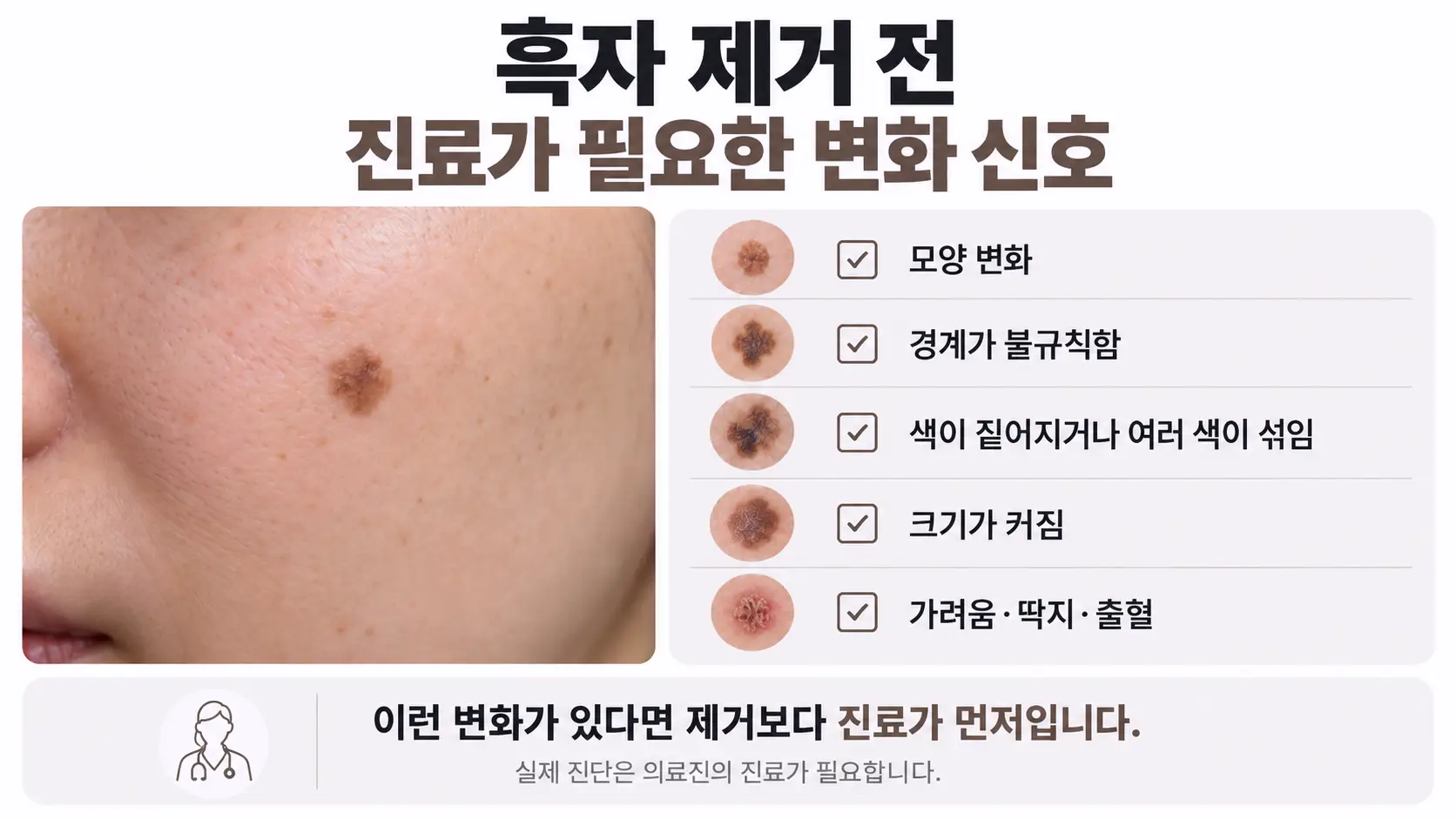 흑자 제거를 미루고 진료를 먼저 받아야 하는 반점 변화와 피부 상태 체크리스트