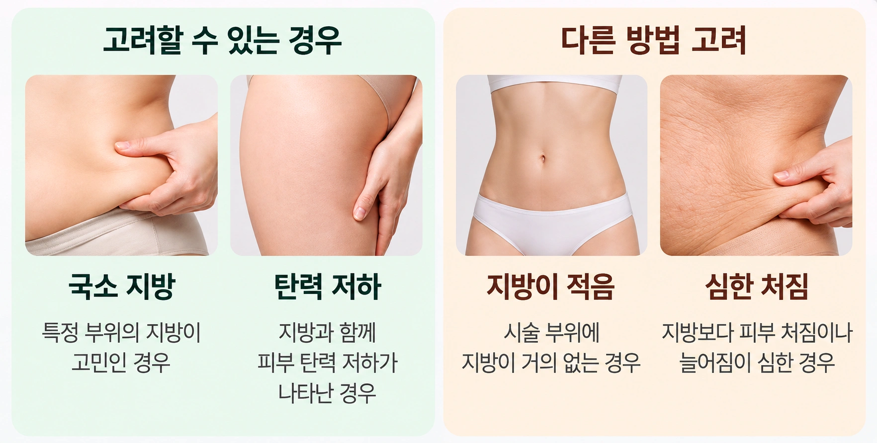 지방량과 피부 처짐 정도에 따른 바디 인모드 적용 기준