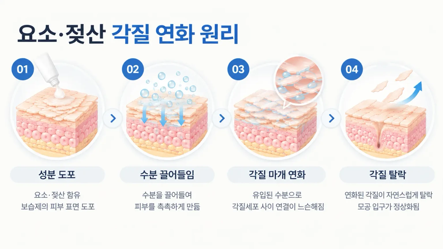 요소와 젖산이 각질 마개에 수분을 끌어들여 연화하고 탈락을 돕는 과정을 단계별로 나타낸 흐름