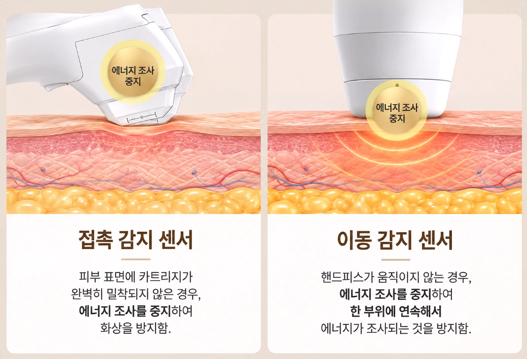 브이로 어드밴스 핸드피스의 접촉 감지 센서와 이동 감지 센서 작동 원리를 비교한 의료 인포그래픽
