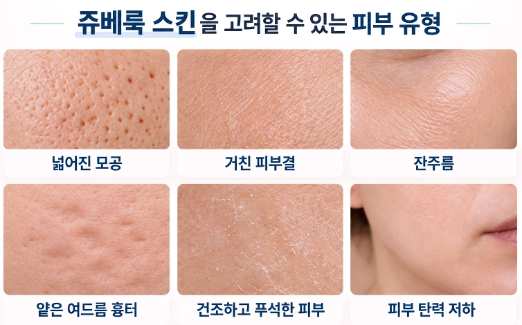넓어진 모공·거친 피부결·잔주름·얕은 여드름 흉터·건조함·탄력 저하 등 쥬베룩 스킨을 고려하는 피부 고민을 정리한 이미지