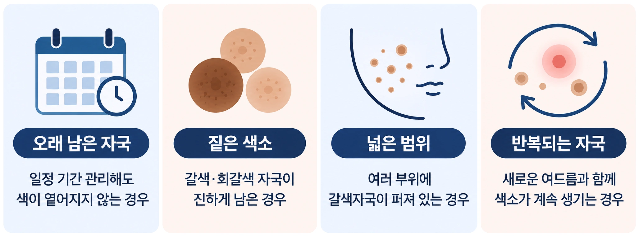오래 남은 자국·짙은 색소·넓은 범위·반복되는 자국 등 여드름 갈색자국 치료를 고려할 수 있는 기준을 정리한 인포그래픽