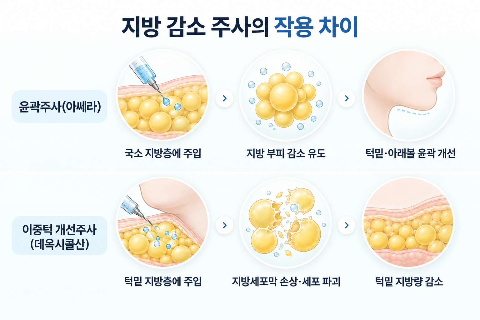 윤곽주사 아쎄라의 국소 지방 부피 감소 과정과 데옥시콜산 이중턱 개선주사의 지방세포막 손상 및 지방세포 감소 원리 비교
