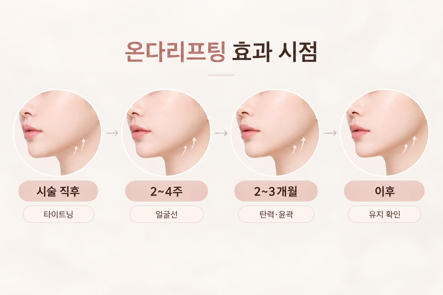 온다리프팅 시술 직후부터 2~4주 2~3개월 이후까지 효과 시점을 보여주는 타임라인