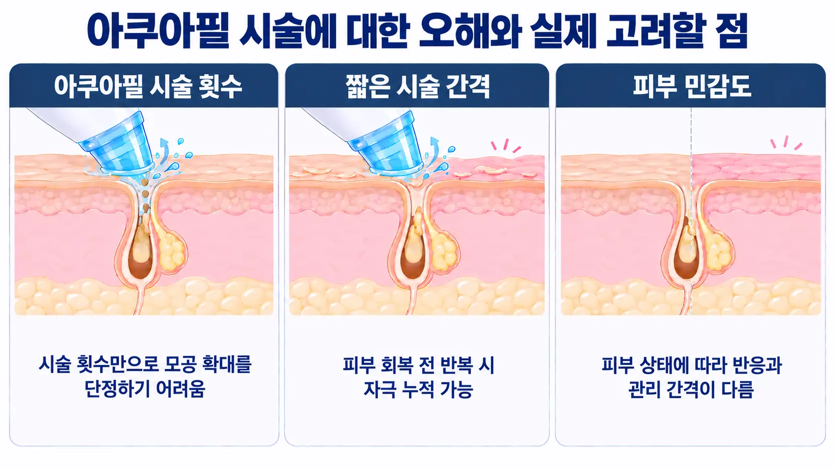 아쿠아필 시술 횟수와 간격, 피부 민감도에 따른 모공 관리 및 피부 반응 인포그래픽