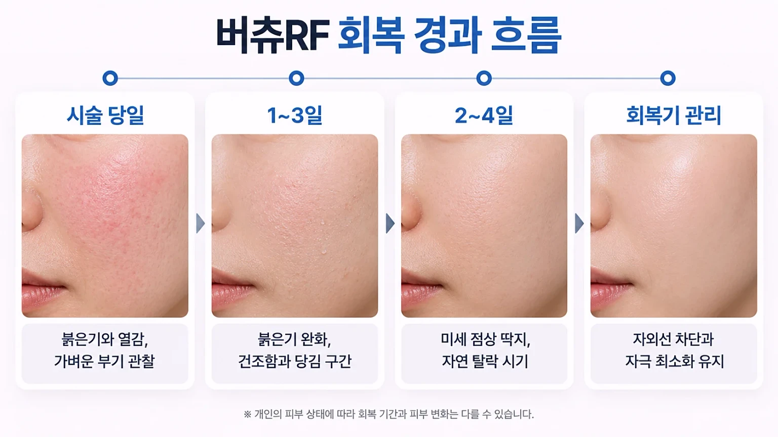 시술 당일 붉은기부터 점상 딱지 탈락, 피부 안정까지의 시기별 회복 경과 안내 이미지