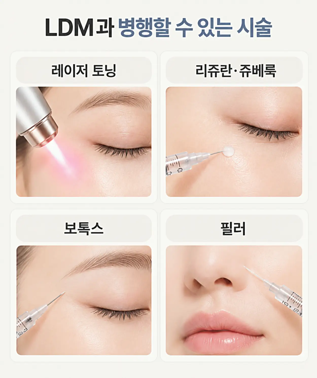 LDM과 병행할 수 있는 레이저 토닝, 리쥬란·쥬베룩, 보톡스, 필러 4가지 시술을 비교한 이미지