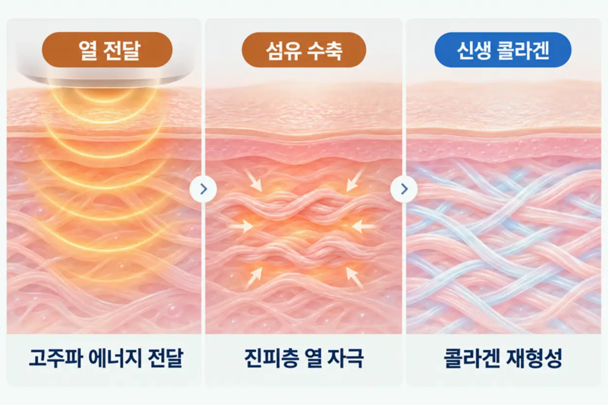 볼뉴머 전후 변화가 나타나는 원리