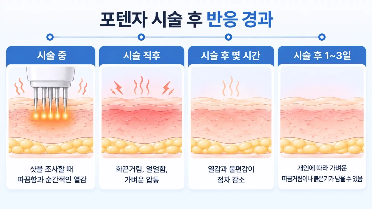 시술 직후 열감부터 붉은기, 미세 점 자국이 가라앉기까지 시기별 관리를 정리한 경과 이미지