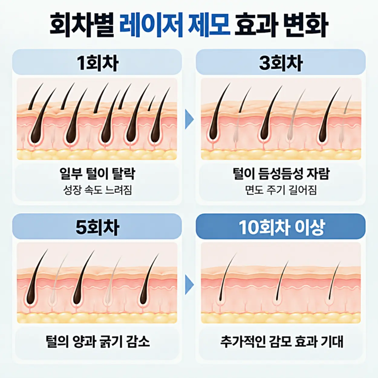 1회차, 3회차, 5회차, 10회차 이후로 피부 표면 털이 듬성해지고 가늘어지는 변화를 정리한 흐름
