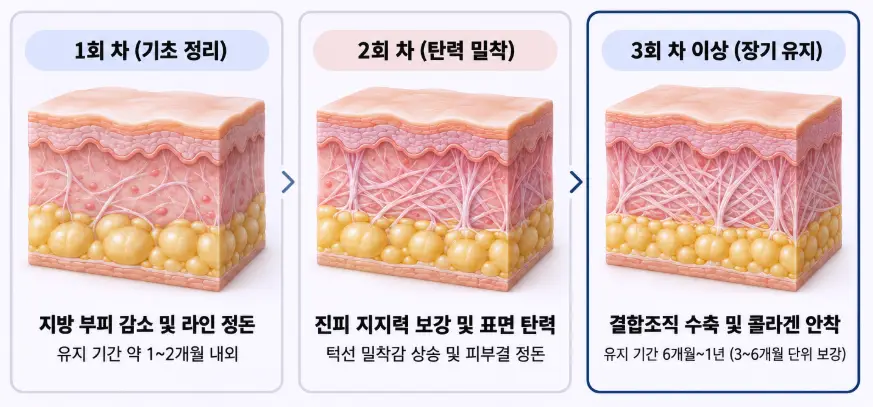 온다 레이저 1회 차 지방 부피 감소부터 3회 차 이상 콜라겐 안착까지의 회차별 피부 조직 변화 및 유지기간 안내