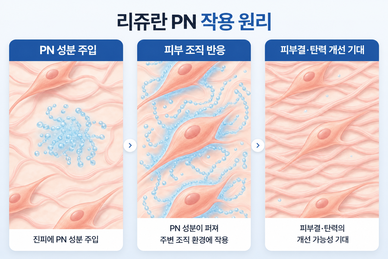 리쥬란 힐러의 피부결 개선 원리, 진피에 주입된 PN 성분과 주변 피부 조직의 반응 및 피부결과 탄력 변화의 3단계 과정