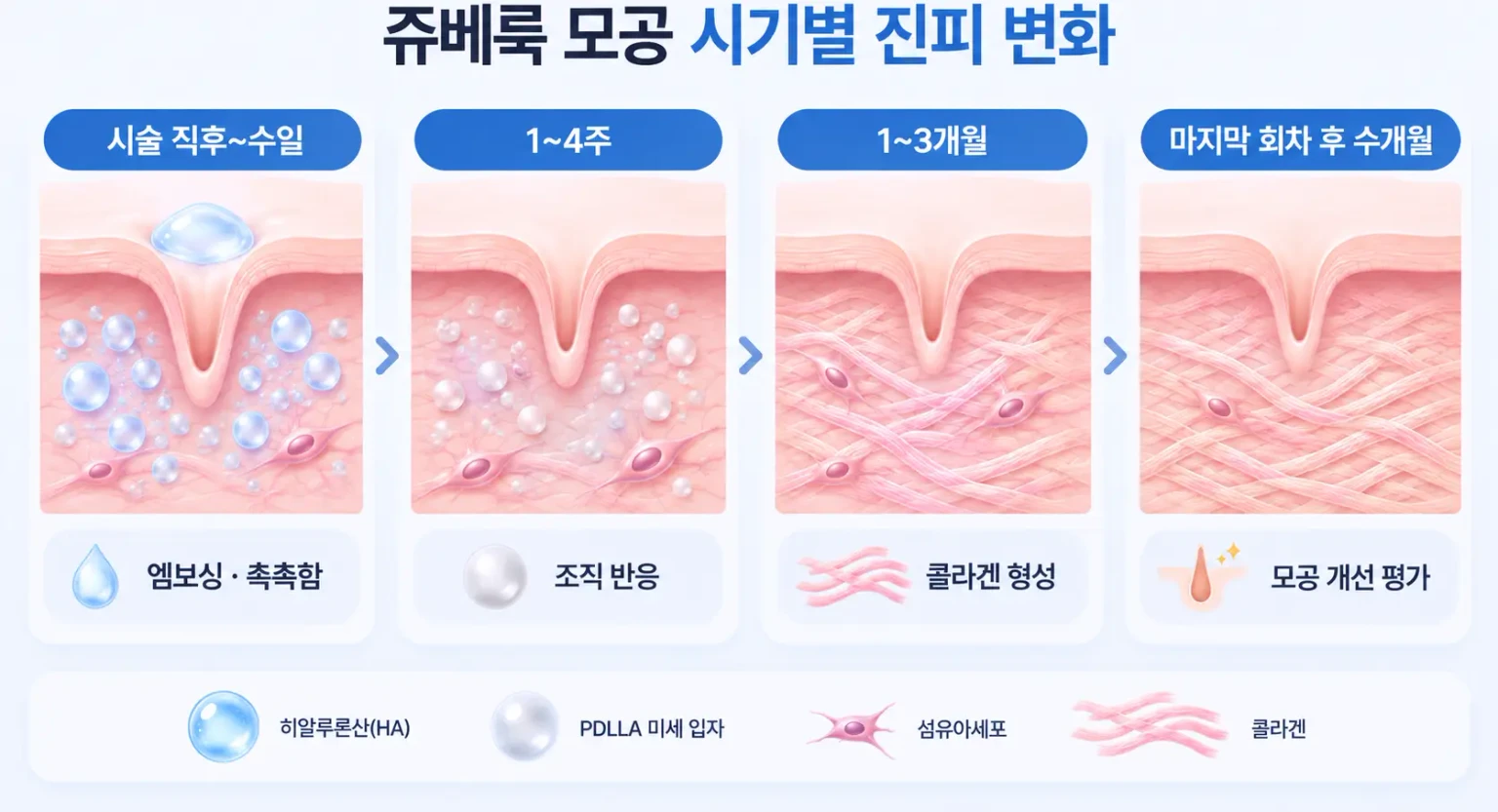 시술 직후 수분감부터 수개월 뒤 진피 밀도 변화까지 시기별로 정리한 쥬베룩 모공 경과 흐름