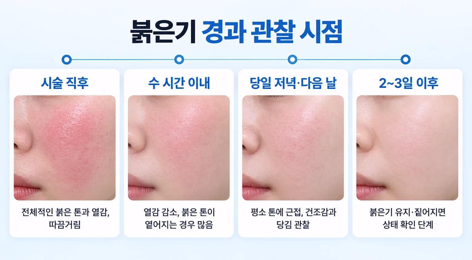시술 직후부터 2~3일 이후까지 붉은기와 열감 변화를 시점별로 정리한 경과 흐름 이미지