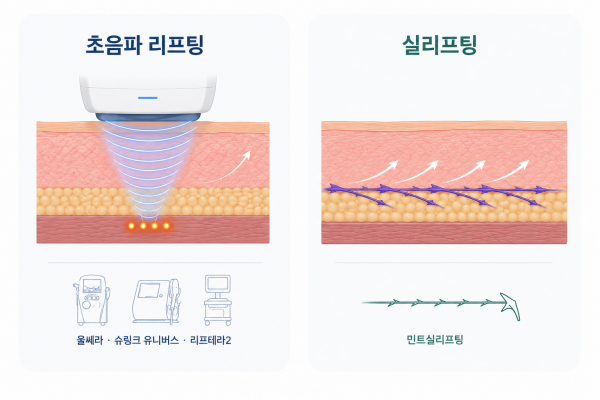 초음파 리프팅의 피부층 에너지 전달과 실리프팅의 피하조직 지지 원리 비교