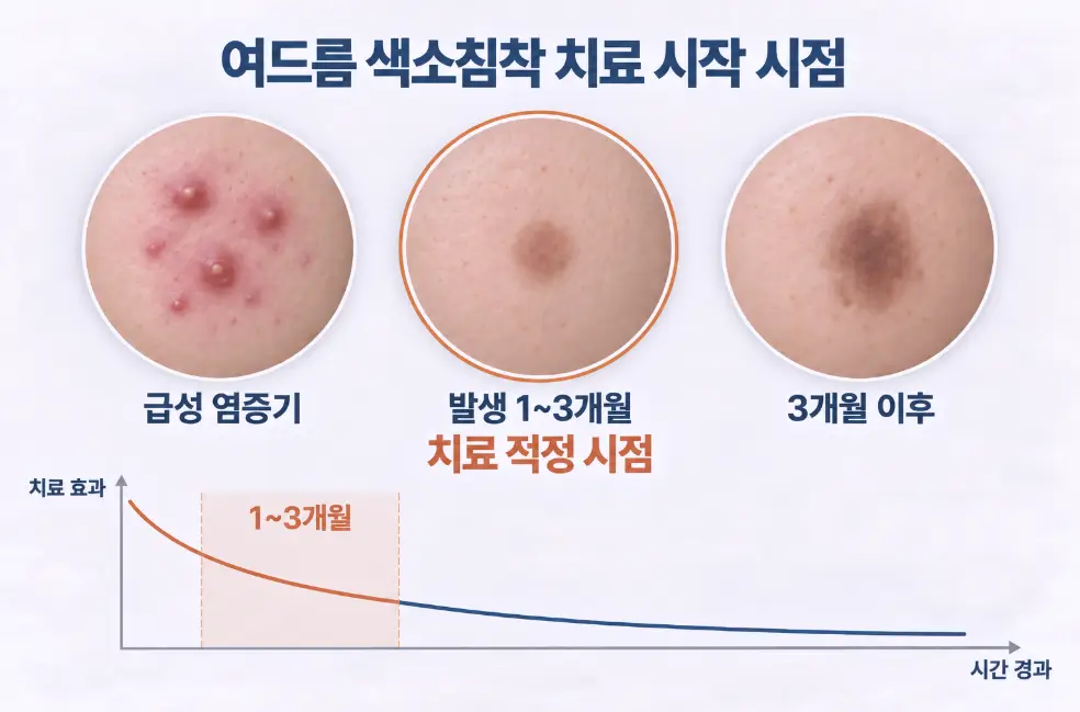 급성 염증기 이후 발생 1개월에서 3개월 사이 적정 여드름 색소침착 치료 시점을 나타낸 그래프