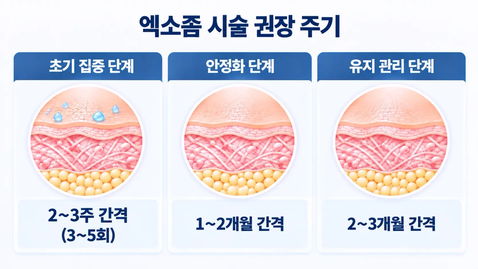 엑소좀 시술 주기와 단계별 관리 간격을 설명한 이미지