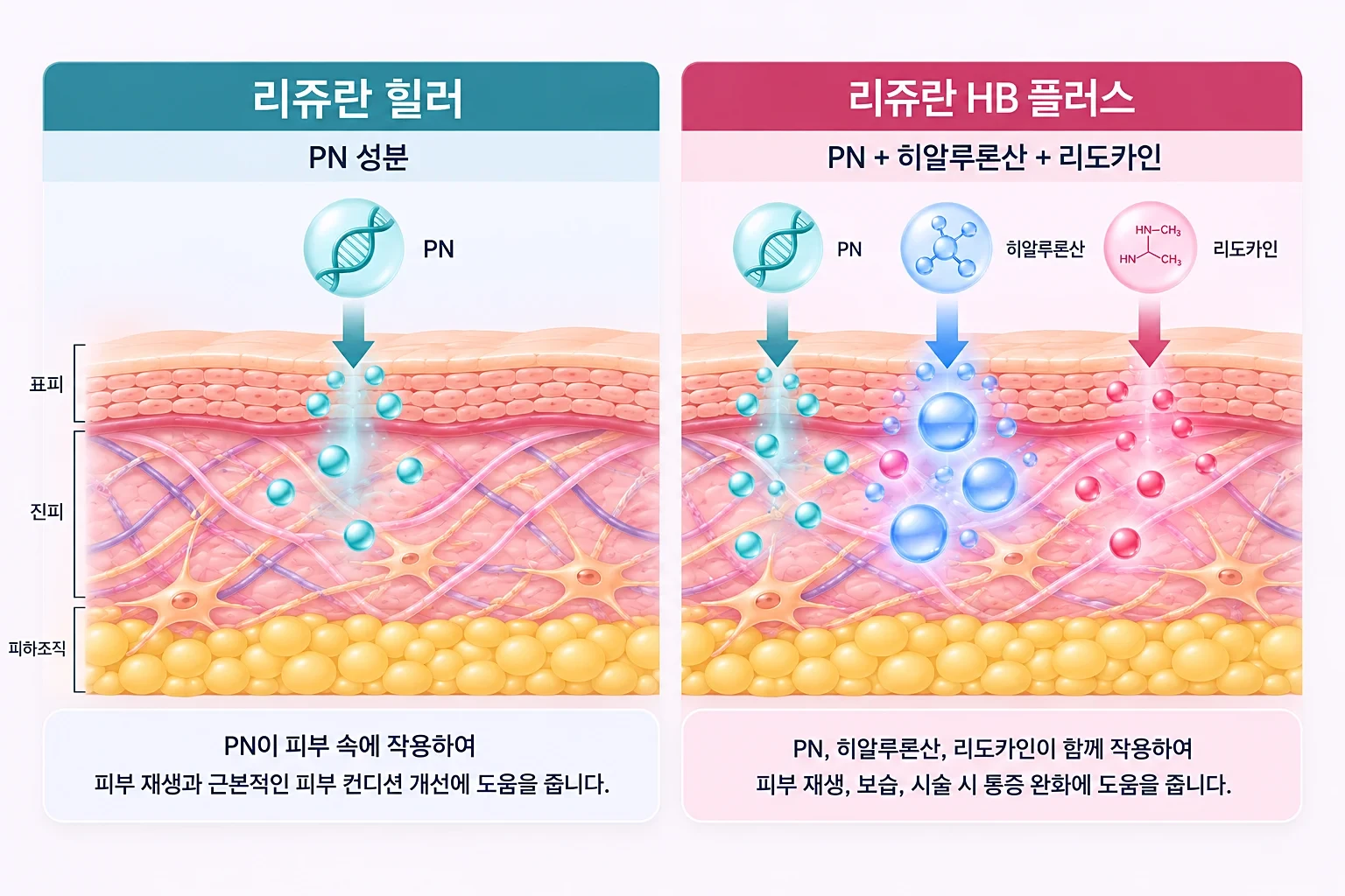 리쥬란 힐러, HB, HB플러스의 PN 사슬과 히알루론산, 리도카인 구성을 비교한 성분 개념도