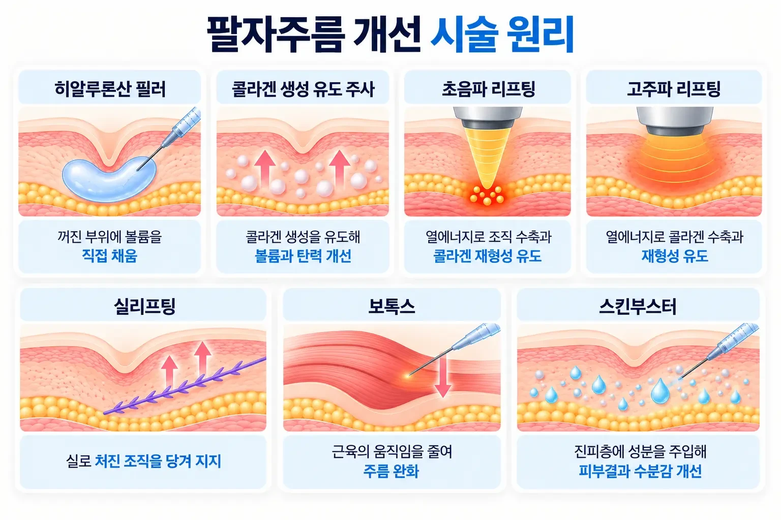 팔자주름 개선 방법 7가지 시술의 피부층별 작용 원리와 볼륨 보완, 조직 리프팅, 콜라겐 생성