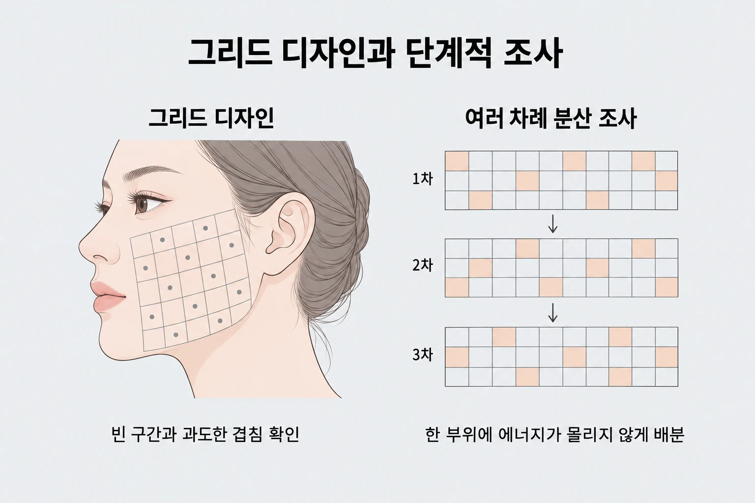 왼쪽 얼굴의 격자 디자인으로 빈 구간과 겹침을 확인하고, 오른쪽 단계별 격자로 에너지가 한 부위에 몰리지 않게 배분하는 텐써마 시술 방식을 설명한 이미지