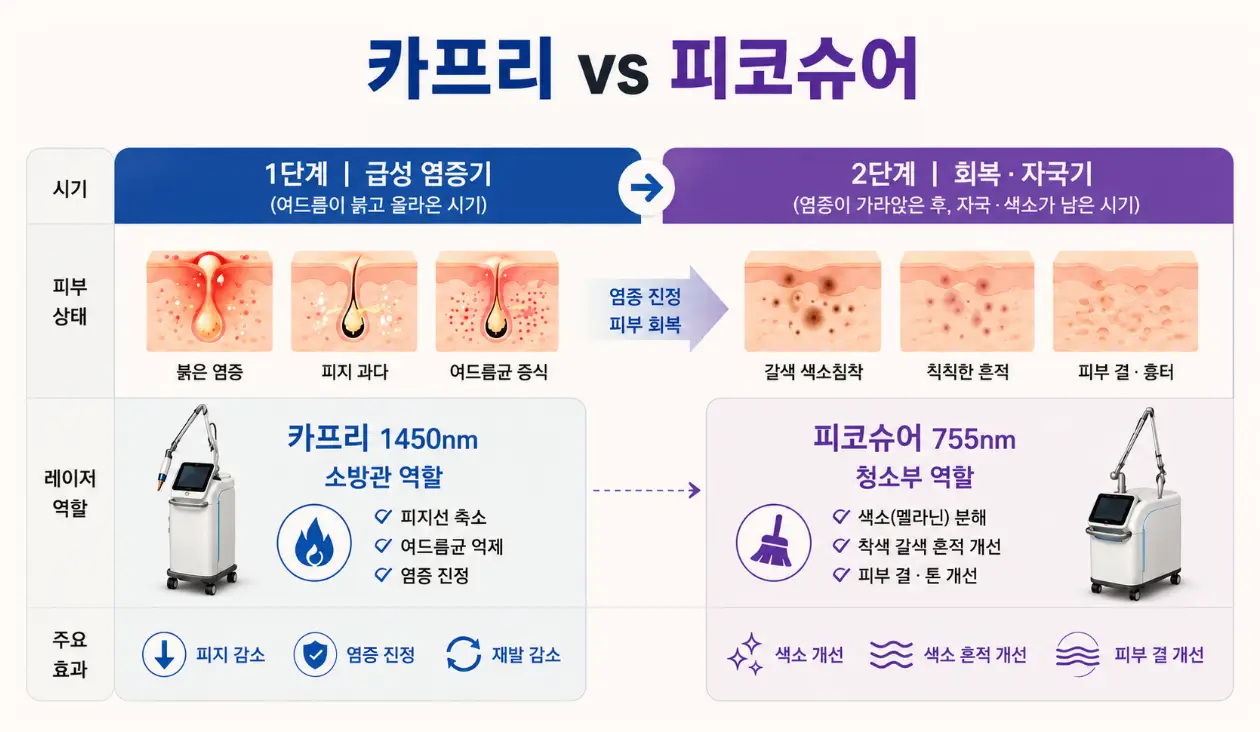 급성 염증기용 카프리 레이저와 회복기용 피코슈어 레이저 시술 비교