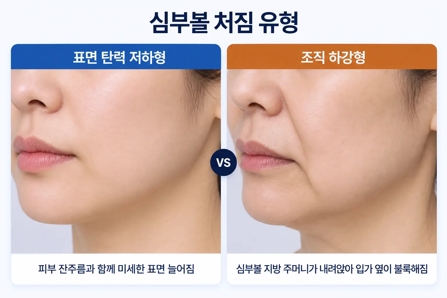 심부볼 처짐 유형별 표면 탄력 저하와 깊은 조직 하강의 특징 비교