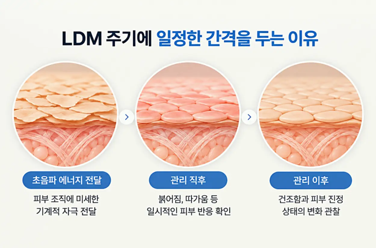 LDM 주기에 일정한 간격을 두는 이유를 설명한 인포그래픽, 초음파 에너지 전달부터 관리 직후 붉어짐·따가움 확인, 관리 이후 건조함과 피부 진정 상태 관찰까지 3단계 피부 변화를 나타낸 이미지