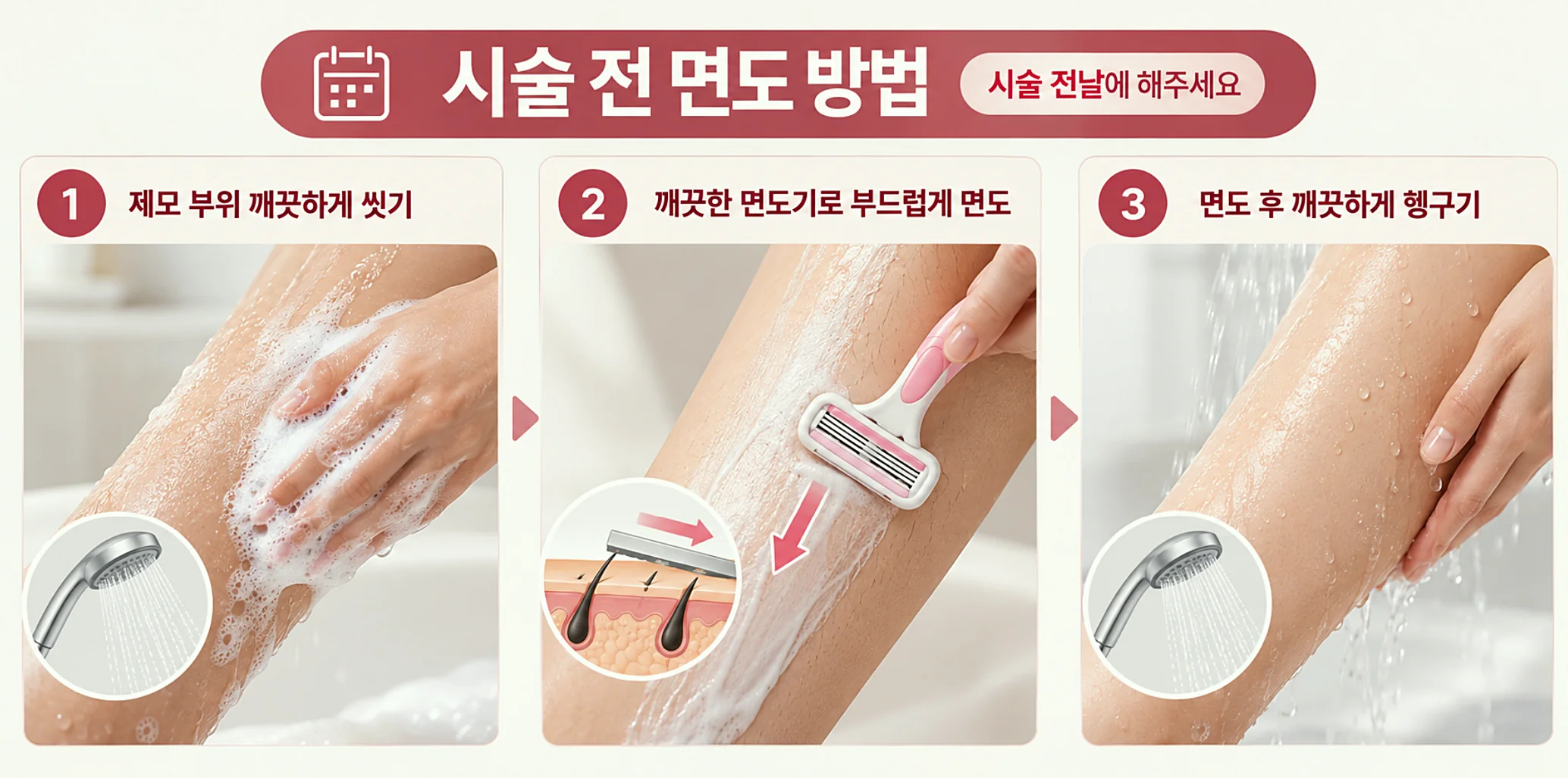 레이저제모 시술 전 면도 방법