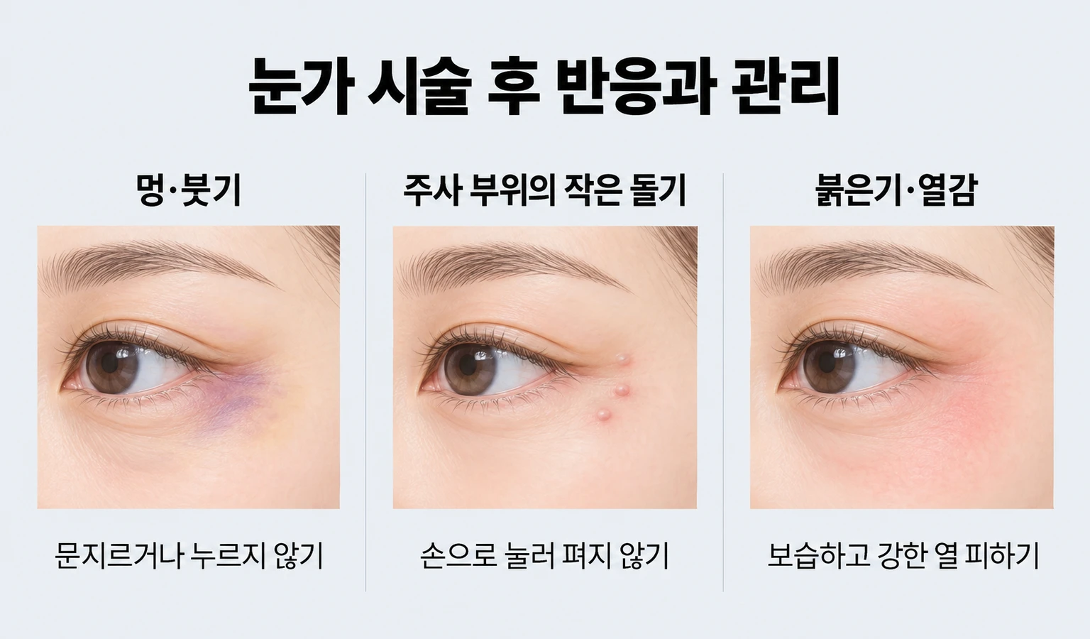 눈가 시술 후 멍·붓기·작은 돌기·붉은기와 자극을 줄이는 관리 방법