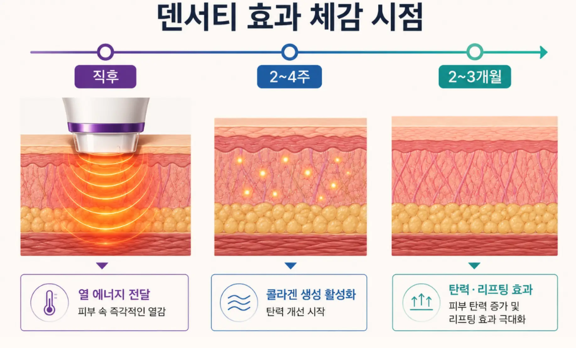 부산 덴서티 효과 시술 직후부터 단계별 체감 시점 그래프