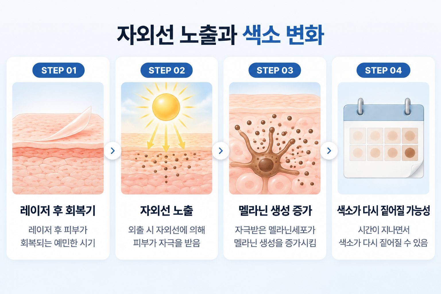 잡티 제거 레이저 후 회복 중인 피부가 자외선에 노출되면 멜라닌 생성이 증가하고 갈색 색소가 다시 짙어질 수 있는 4단계 과정