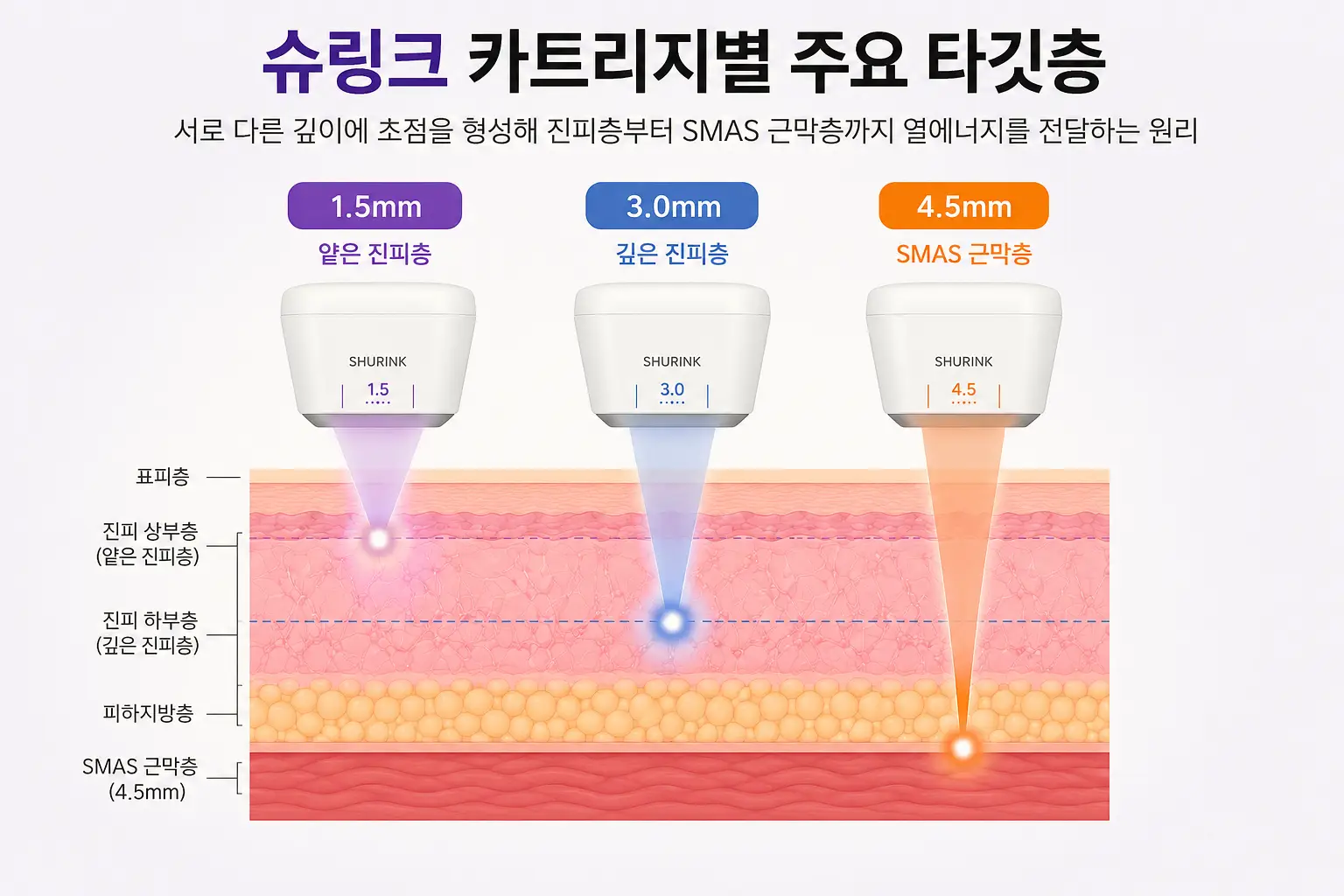 슈링크 1.5mm·3.0mm·4.5mm 카트리지별 주요 타깃층
